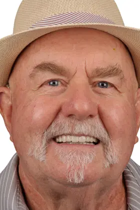 Healthy and symmetrical smile achieved through gum recession correction with grafting.